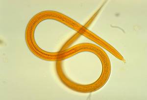 A roundworm. Image:www.cdc.gov