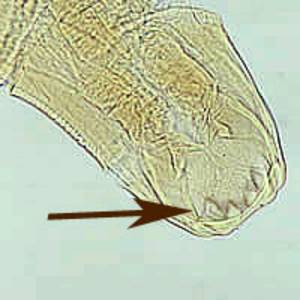The hookworm's mouth - look at those teeth! 